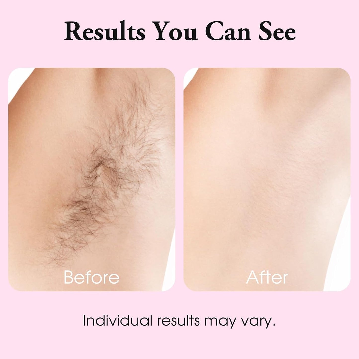 Natural Cyperus Rotundus Oil 60ml Hair Removal Oil Moisturizing Soothing Reduce Body Hair Growth